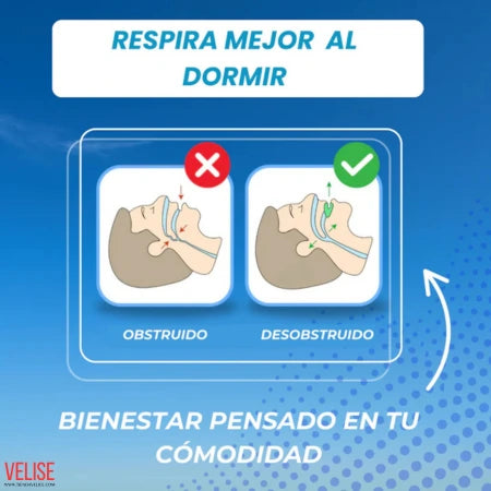 Placa Anti bruxismo, Apnea y Ronquidos